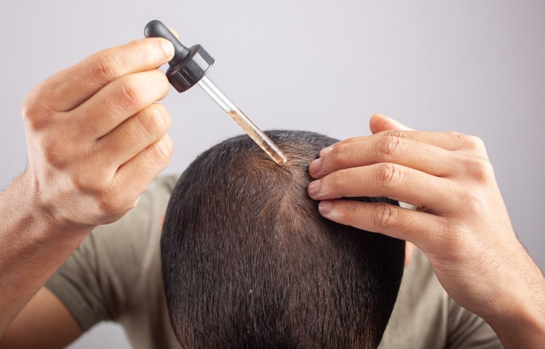 hair loss treatment