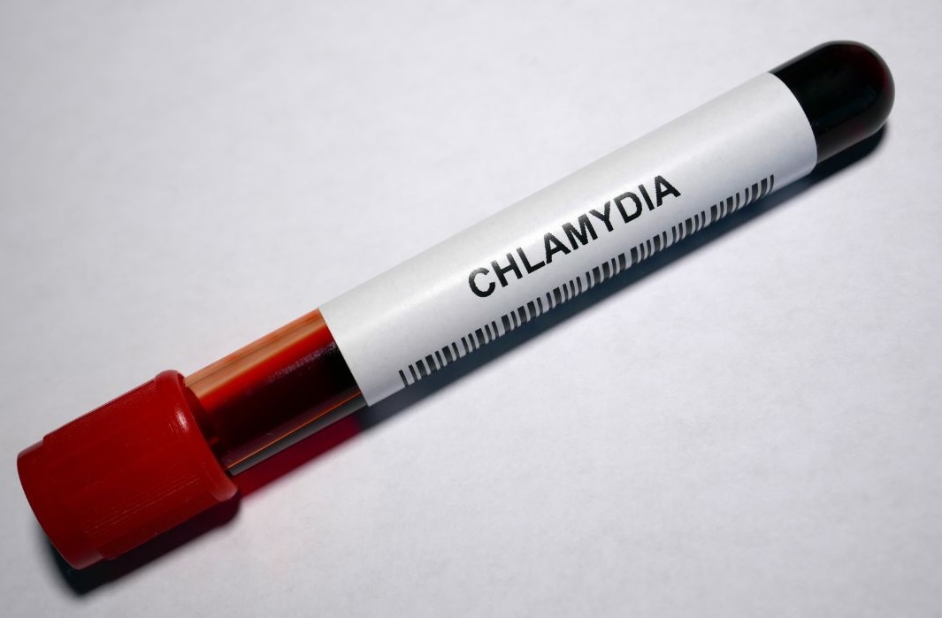 chlamydia signs and symptoms