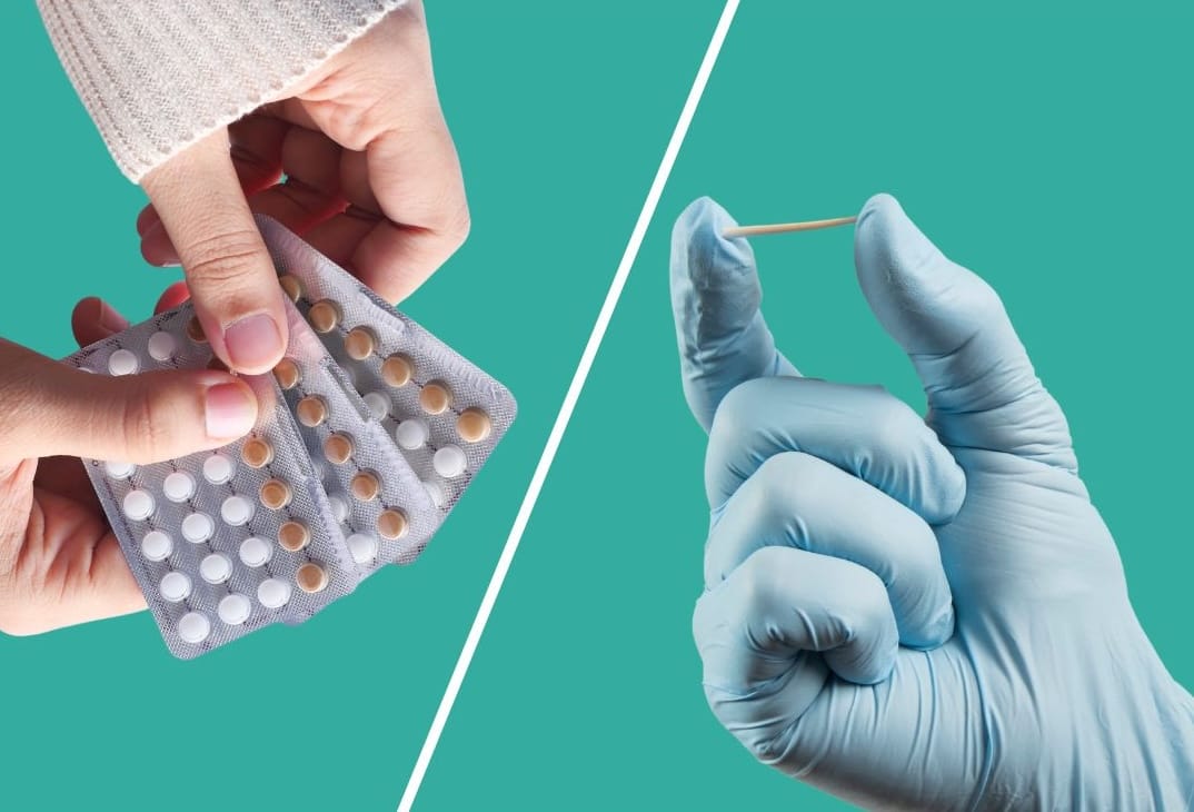 contraceptive pills vs implant