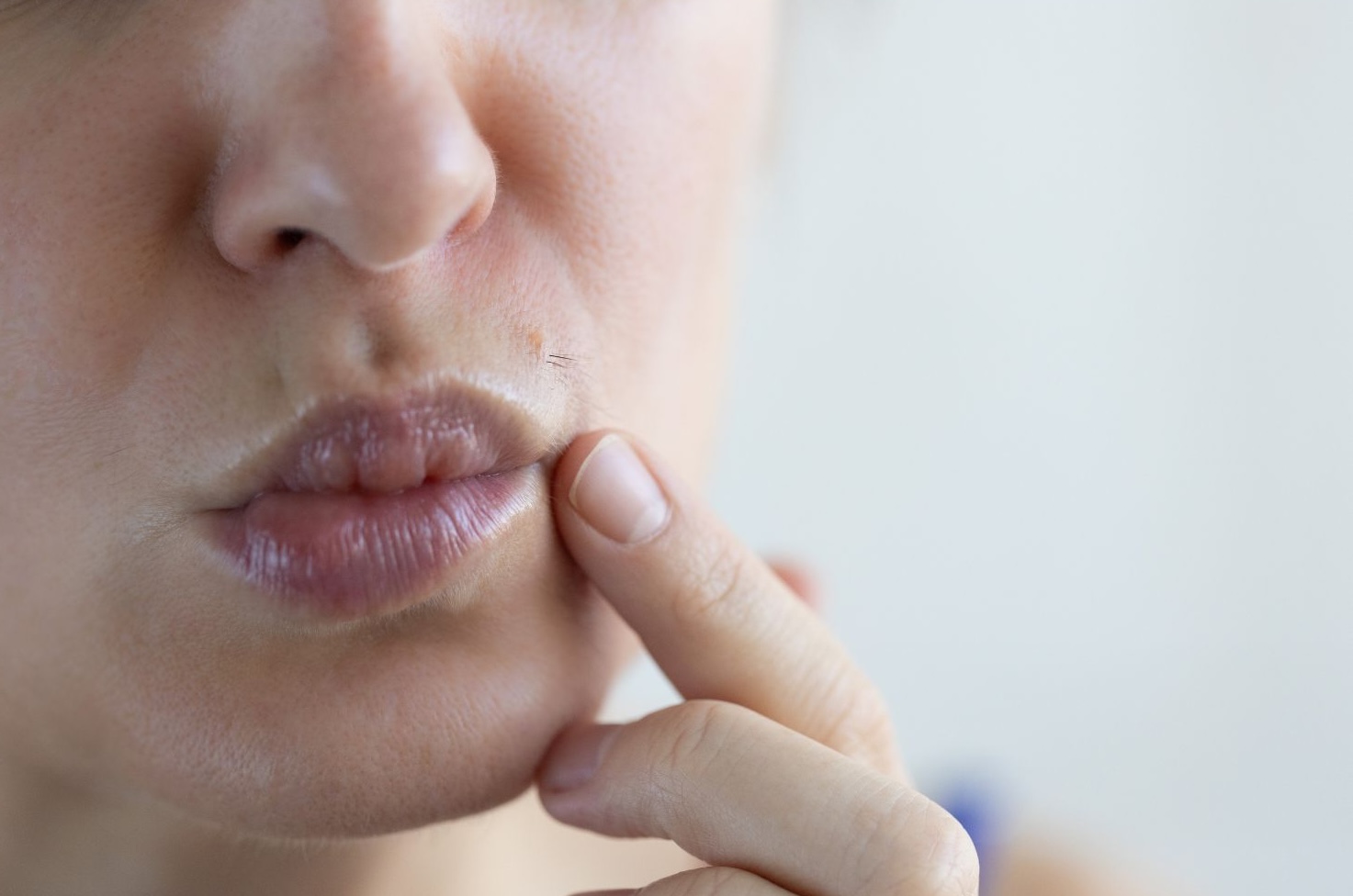 female facial hair