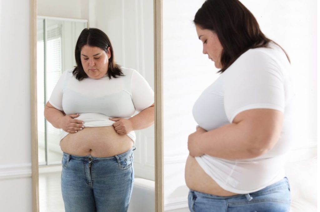 excess body weight