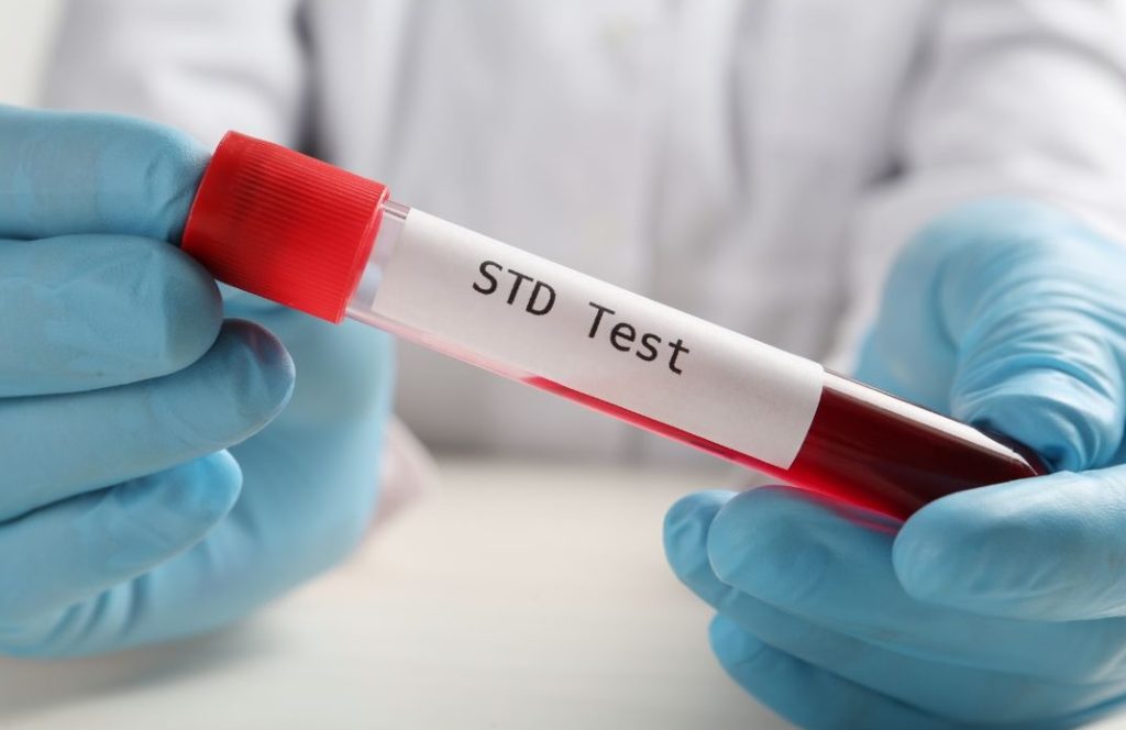sti test