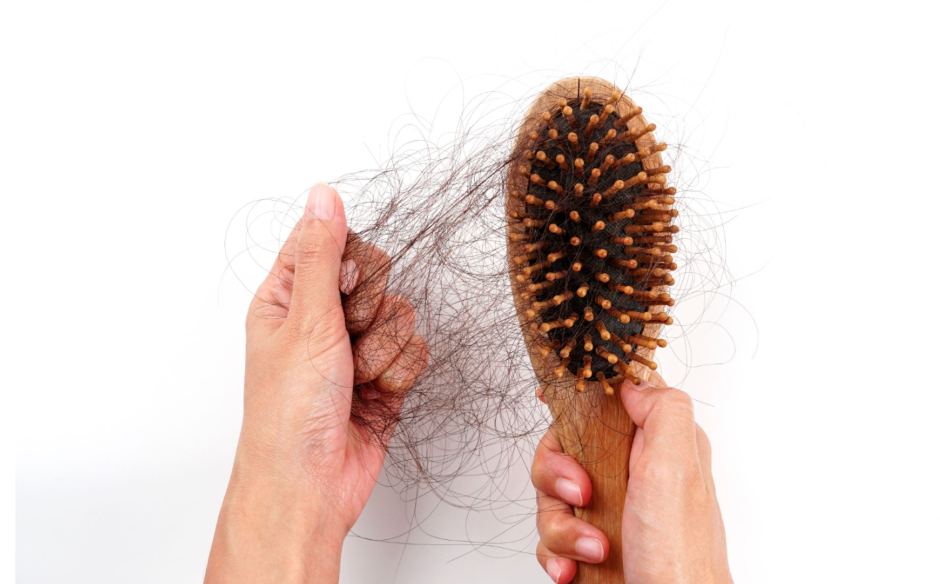 Hands holding a hairbrush with a large amount of shed hair